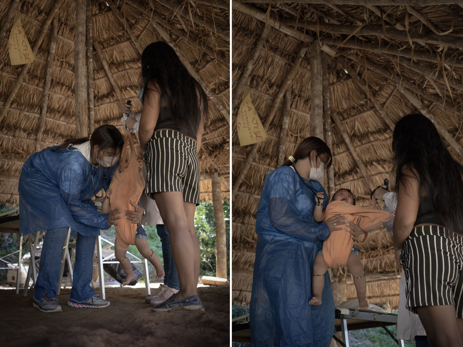 Two side-by-side photos of a doctor weighing a child inside a thatched roof dwelling