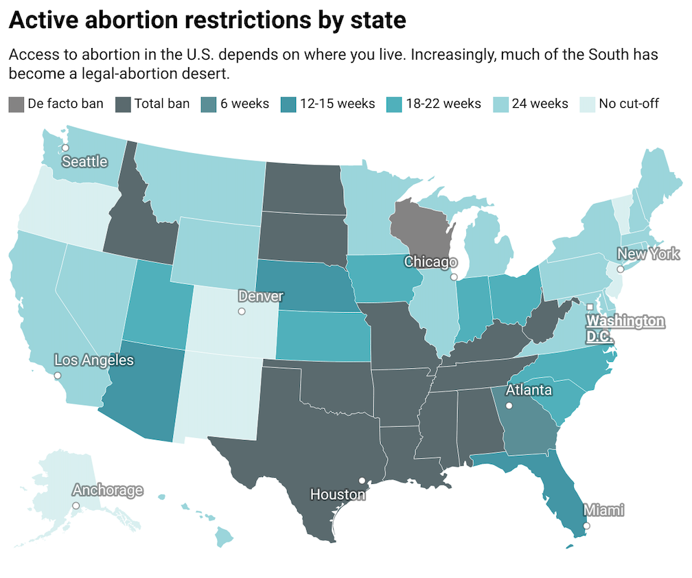 How Major Abortion Laws Compare, State By State | The Fuller Project